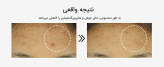 سرم 6 پپتاید جوانساز و تقویت کننده پوست کوزارکس حجم 150ml