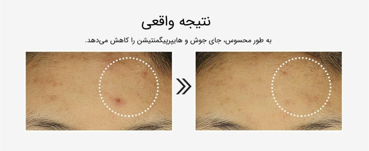 سرم 6 پپتاید جوانساز و تقویت کننده پوست کوزارکس حجم 150ml