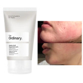 کرم آزلائیک اسید ۱۰% اوردینری Ordinary