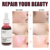 سرم پیلینگ و لایه بردار قرمز اوردینری {اصل کانادا} حاوی AHA30% و BHA2% | حجم 30ml